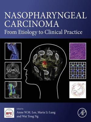 cover image of Nasopharyngeal Carcinoma